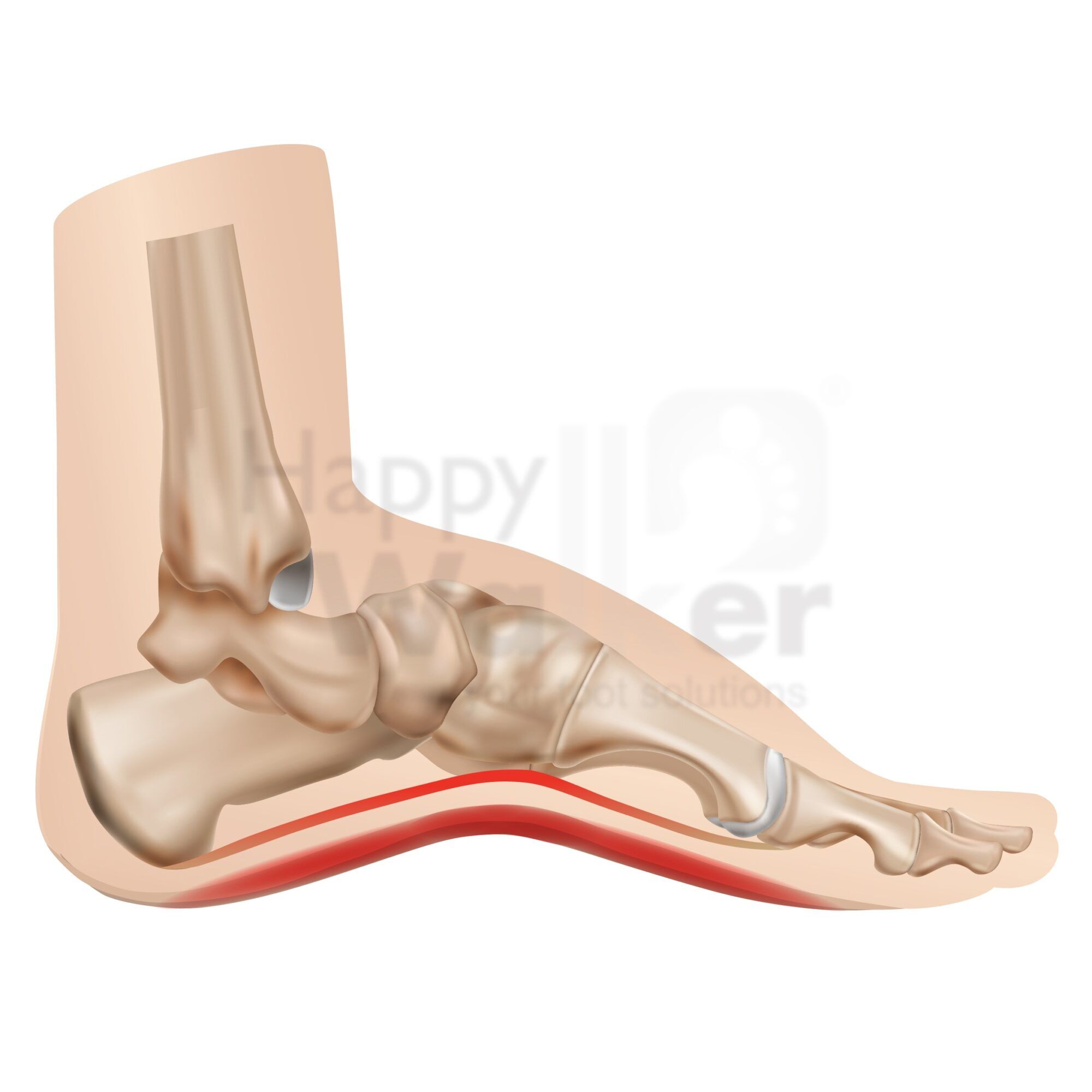 Foot, heel and ankle pain - Geoffrey Fong Osteopath Camberwell